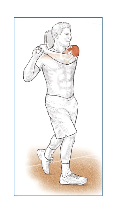 Scapular plane positioning
