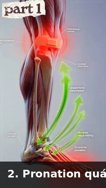 Sciatic nerve path